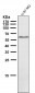 Anti-Phospho-AMPK alpha 2 (S491) PRKAA2 Rabbit Monoclonal Antibody